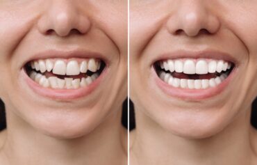 Cosmetic Dentistry