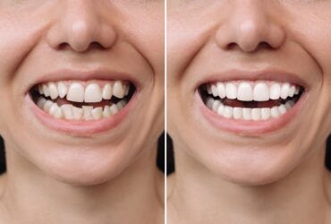 Cosmetic Dentistry